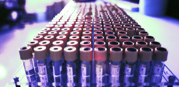 El V Congreso Nacional de Biobancos contará con la presencia de HeraScientific